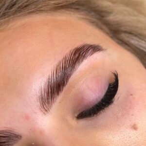 Brow Lift Stuttgart